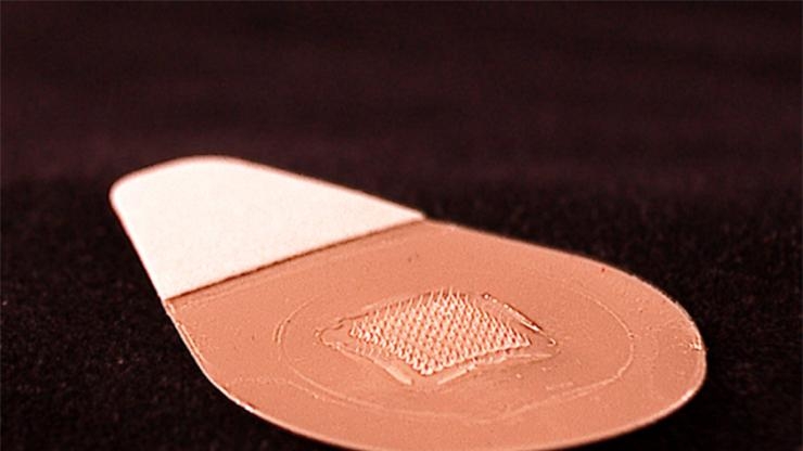 microneedle_patch